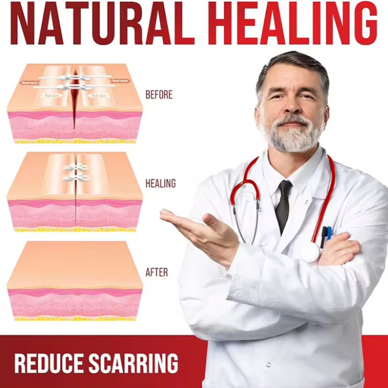 Band Aid Butterfly Bandage Manufacturer Band Aid Butterfly Bandage Manufacturer